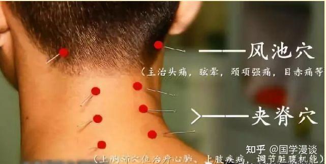 中医治疗颈椎病大全,全是干货