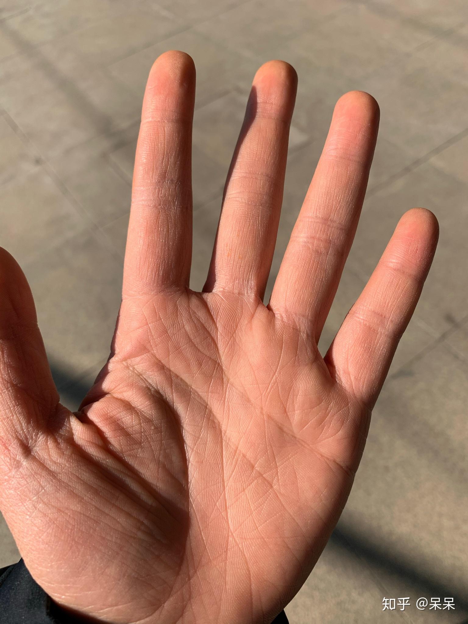 手掌很硬很粗糙怎么办,已经勤擦手霜也有做手膜,还是干涩硬粗糙,感觉