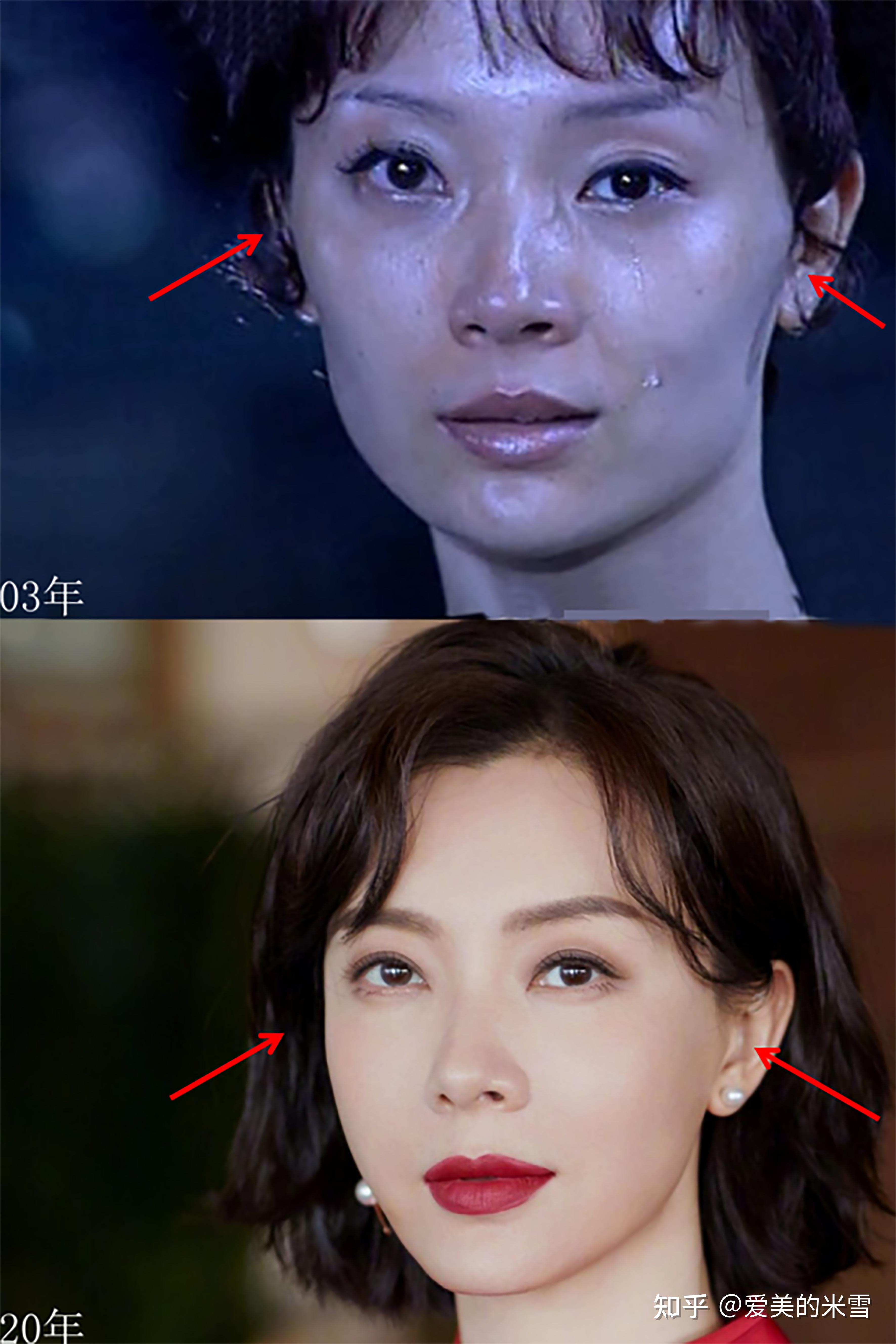 女孩子颧骨低才好看吗? - 知乎