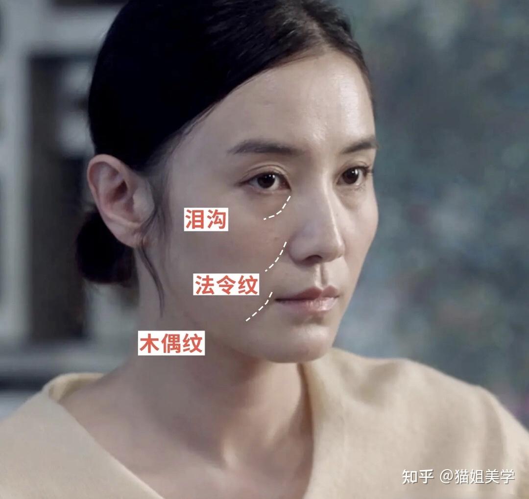 1-三八线(泪沟,法令纹,嘴角纹)这些纹路的走势是向下的,感觉眼睛,嘴巴