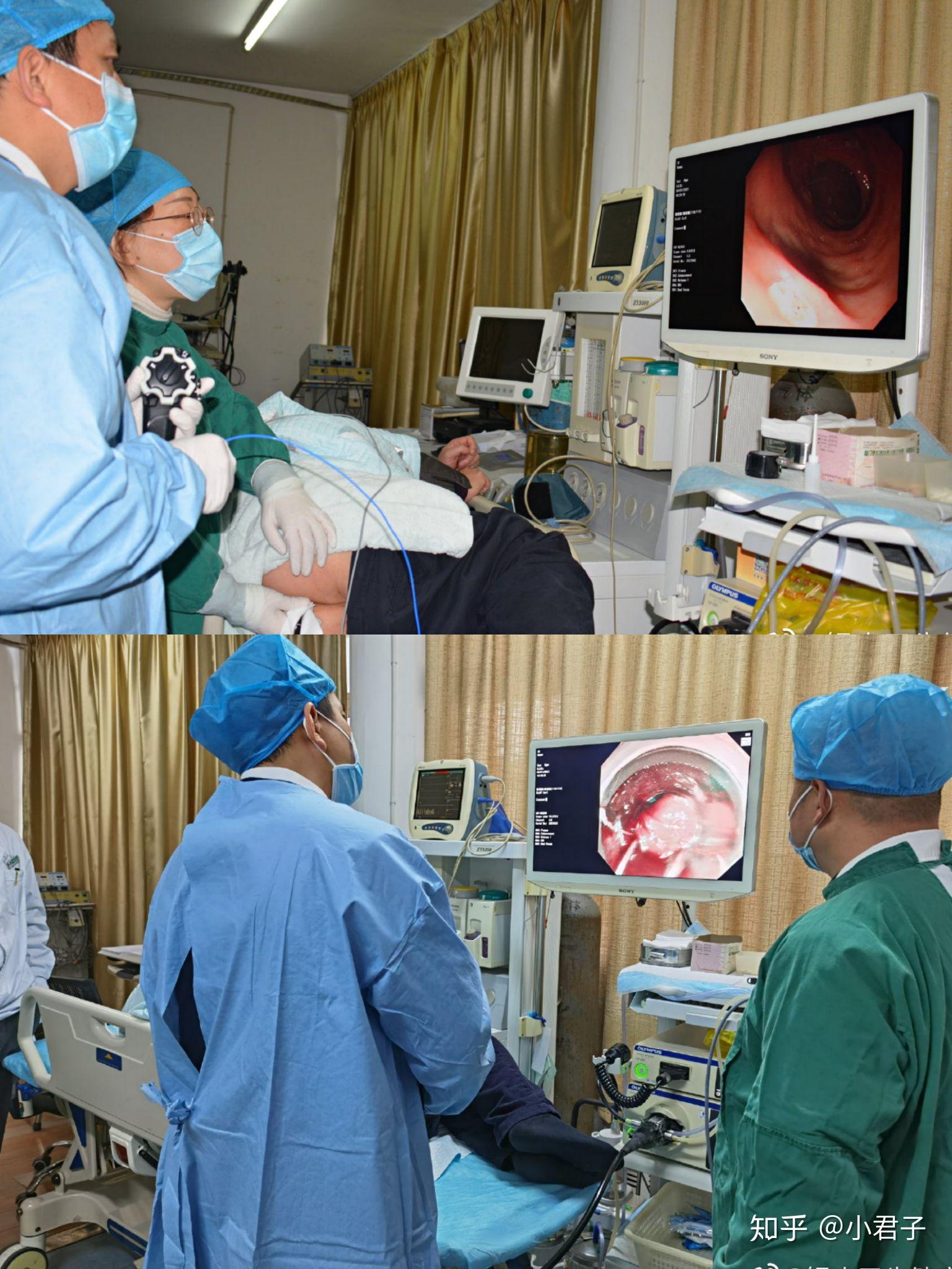 一次去检查痔疮肉球的经历63