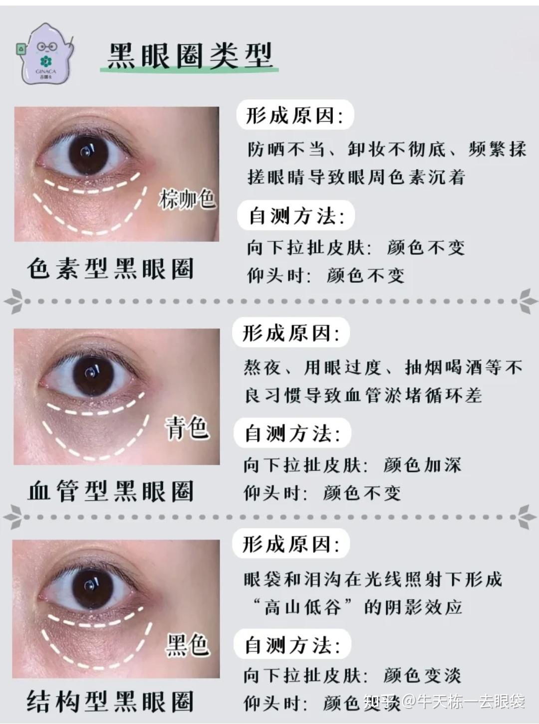 老年人黑眼仁周围有一圈白色的环，正常吗？需要治疗吗？|出现|白色|眼仁|眼科|表现|-健康界