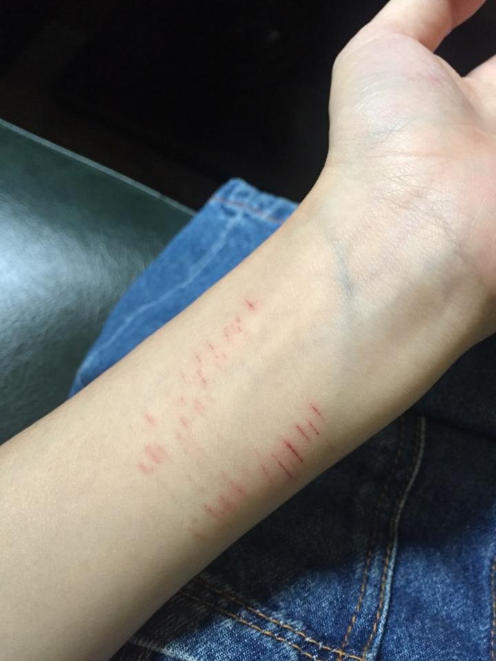 阑尾炎症状是什么样子 v2-2726a24205f8c91d1a941fefd1c3ae25_r.jpg