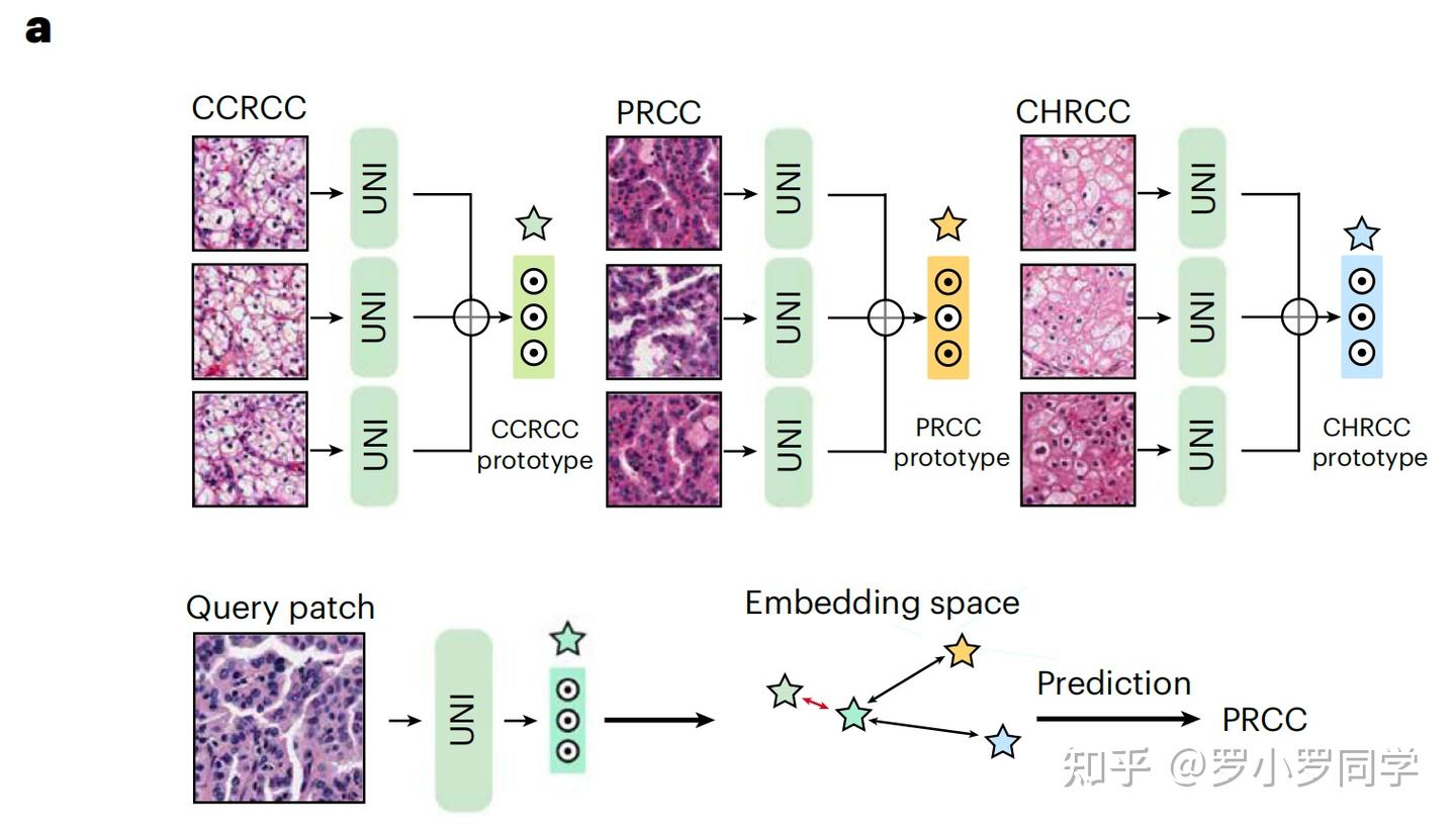 Nature Medicine病理AI汇总｜UNI：一种用于计算病理学的通用自监督基础模型·顶刊精析·24-10-31 - 知乎
