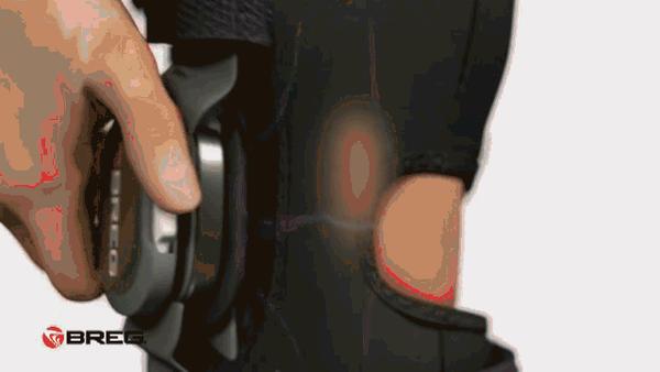 单纯髌股关节磨损非常常见,与伸膝装置的病变和对位不良有关.