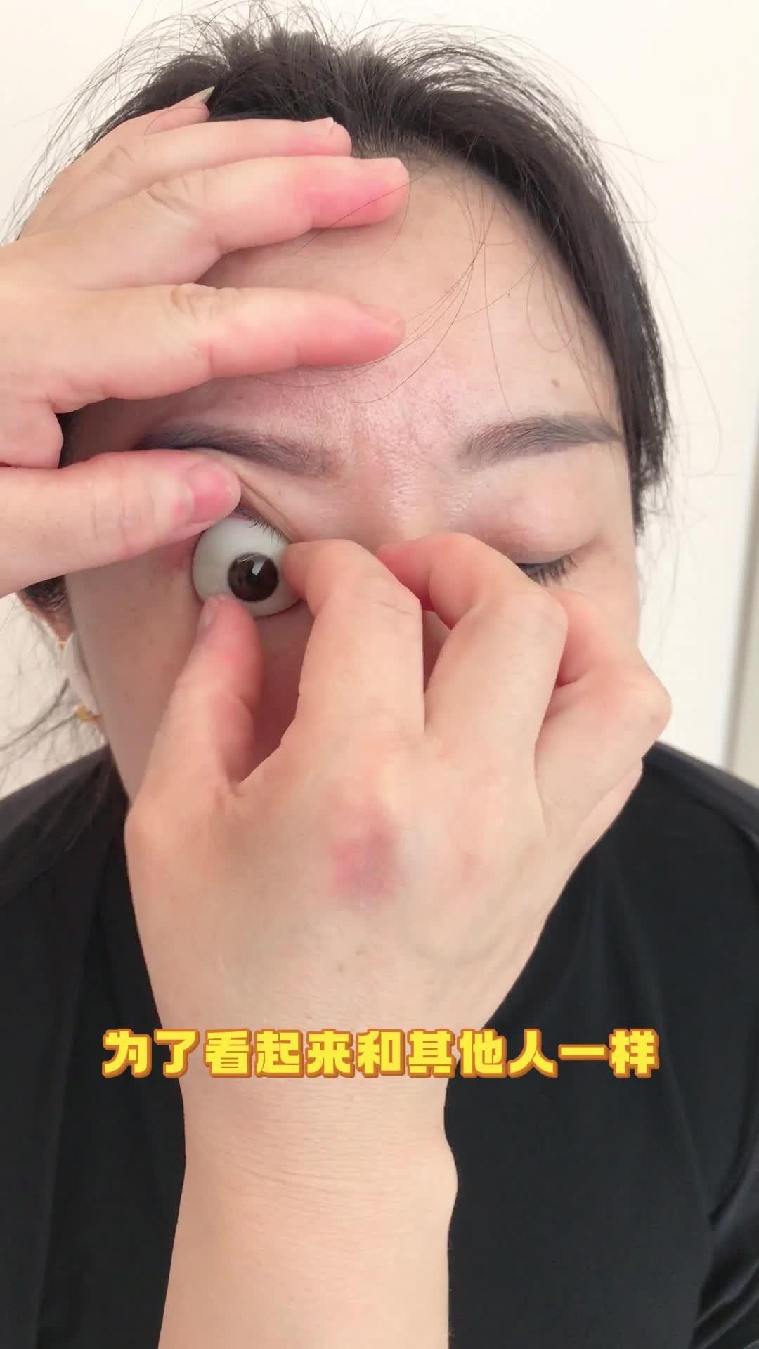右眼失明的小姐姐佩戴义眼片假眼全过程
