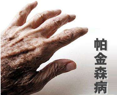 帕金森病早期十大症状