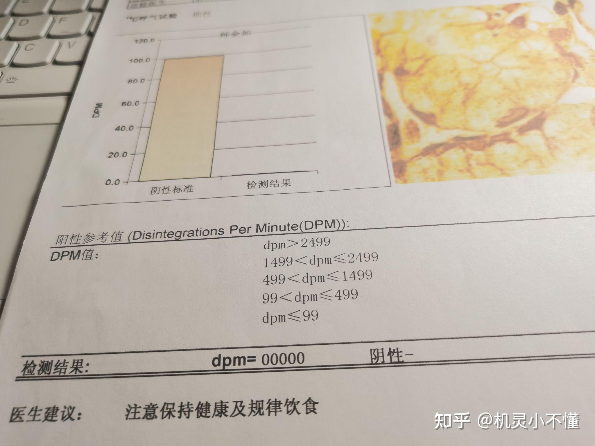 碳14呼气检测正常值