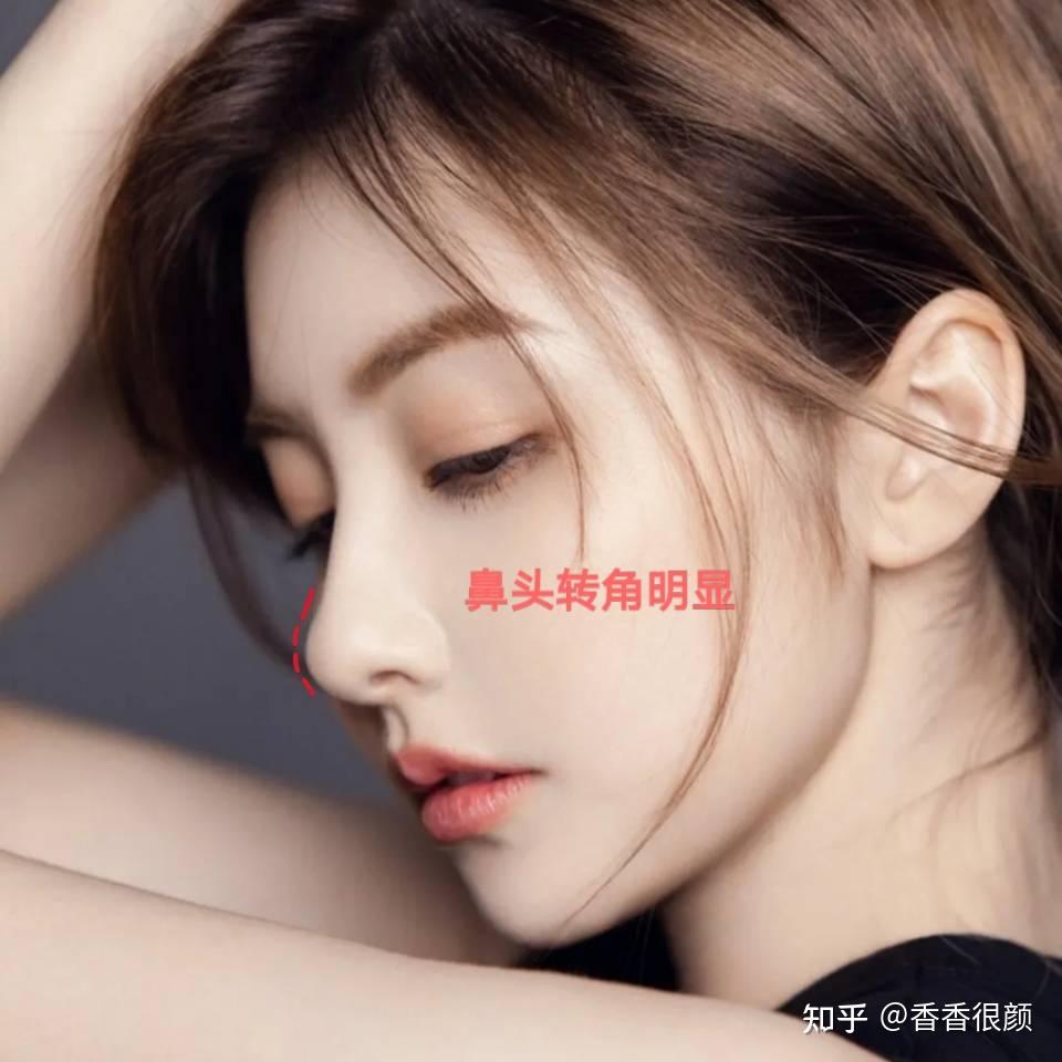 什么叫做妈生款鼻型哪里可以做妈生款自然隆鼻