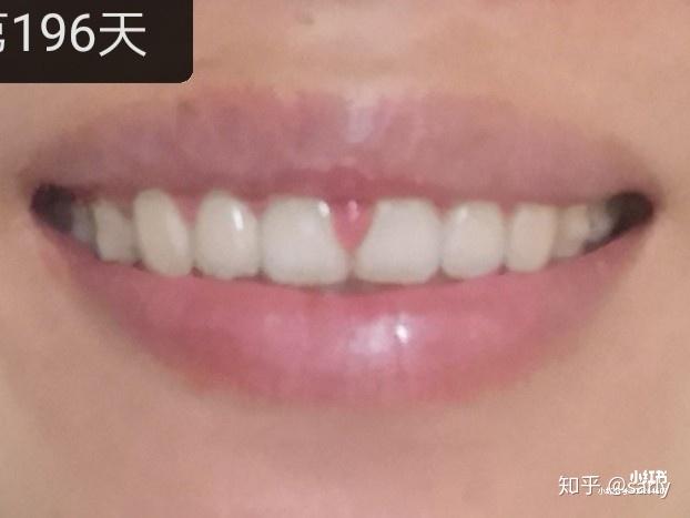 v2-27f4f9a14ac9814c4d152eb94a803b70_r.jpg