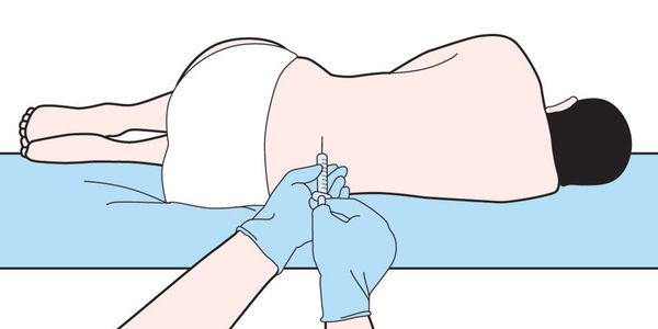 腰椎穿刺对身体的危害大吗