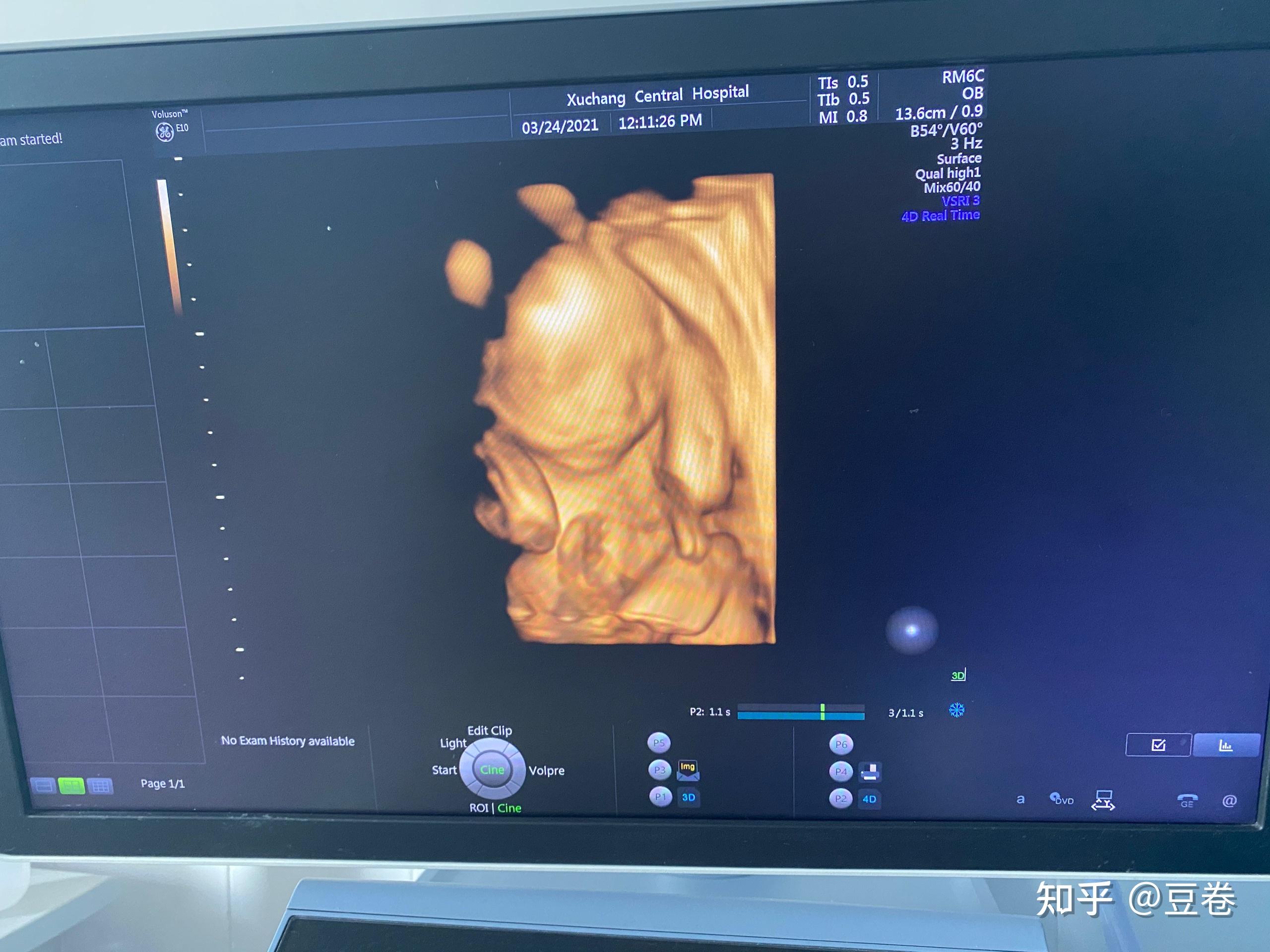 怀孕23周胎儿图片图片