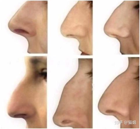 刘亦菲的驼峰鼻为什么充满“仙气”? - 知乎