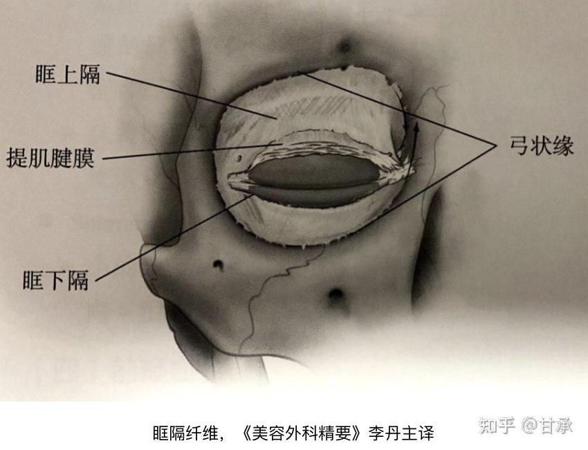 眶骨膜图片