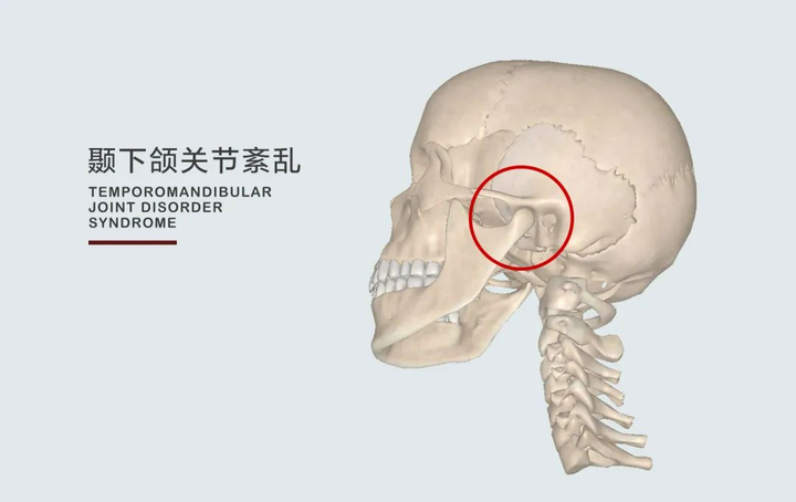 颞下颌关节紊乱综合征的康复治疗 - 知乎