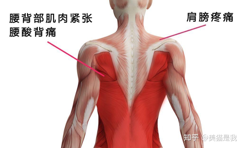 怎么才能知道自己是不是骨盆前倾 v2-293e2392cc561f114cbc3f24aa25f860_r.jpg