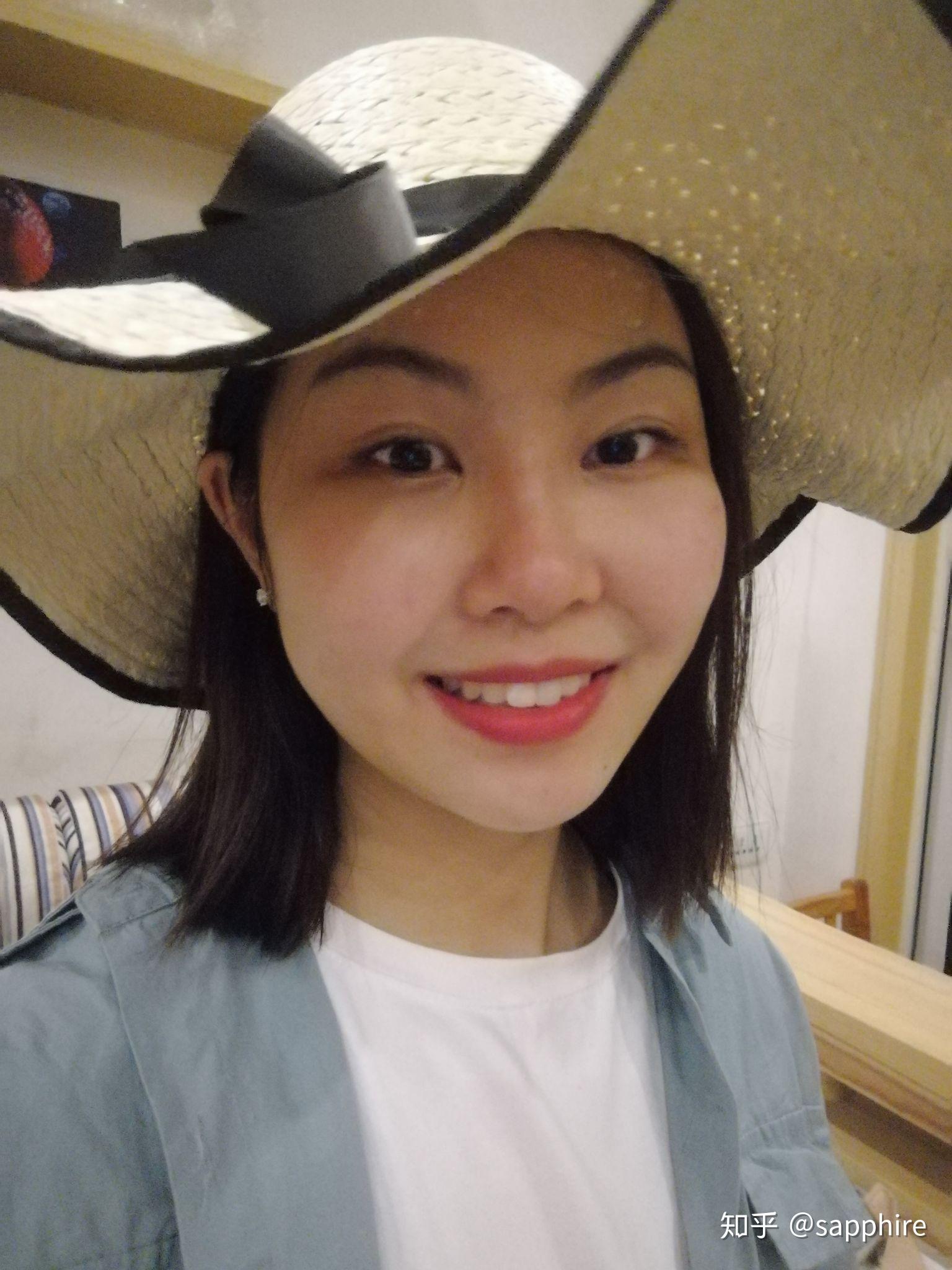 光纤溶脂,面部吸脂,瘦脸针,请做过的女生来,不要