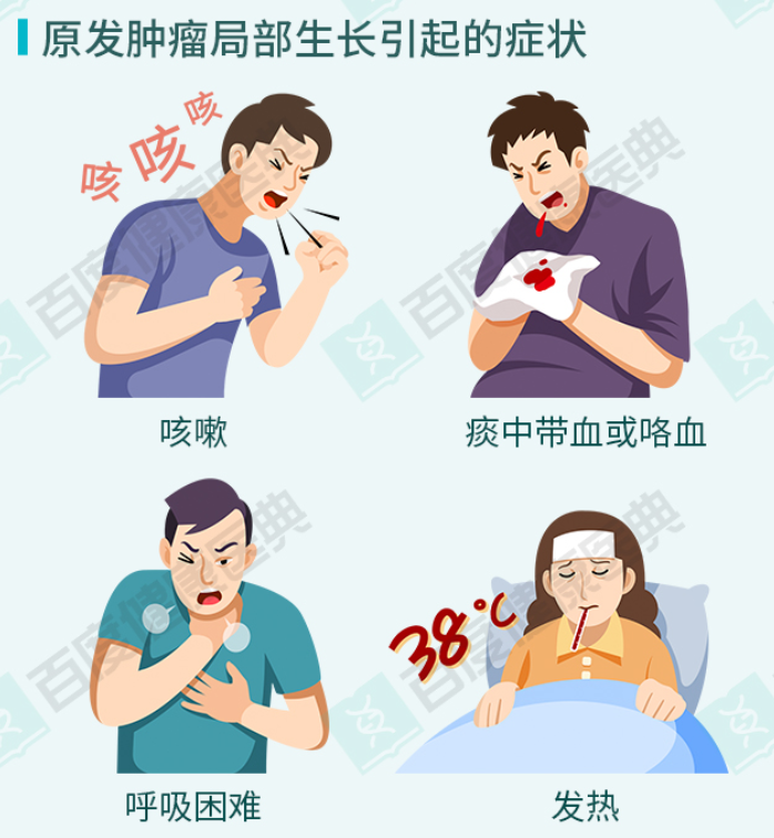 肺癌离我们有多远链家创始人最近也因为肺癌去世了如何避坑了解下