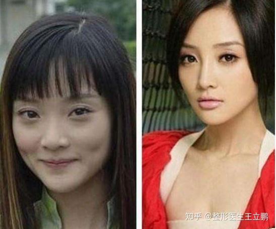 这种鼻型侧颜鼻子挺高 可正面看不出来 怎么拯救 知乎