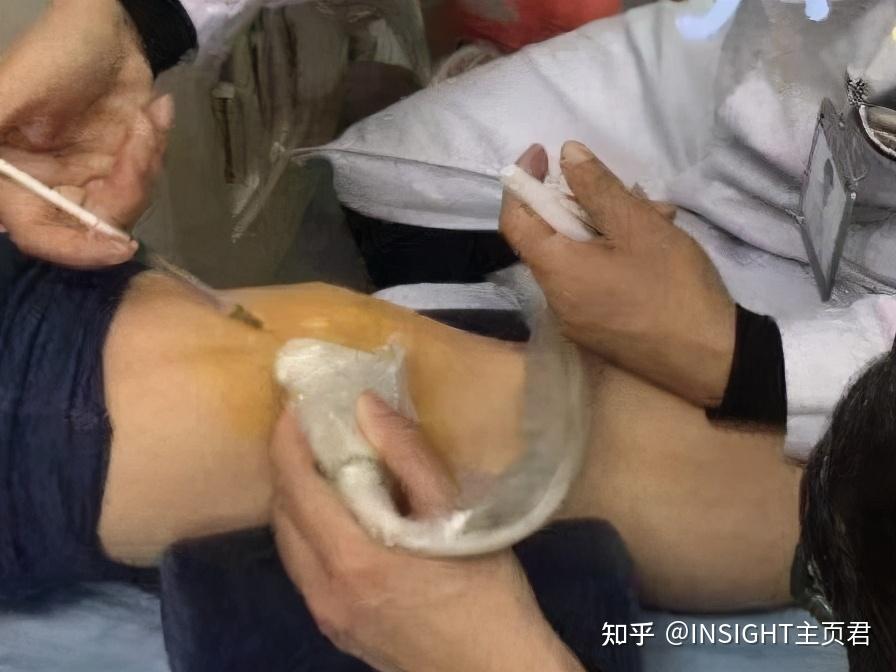 别「碰瓷」世界冠军马龙、张继科!!!-马龙张继科最经典的一战