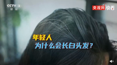 “少白头”的人身体究竟怎么了?白发的位置「暗示」 哪些健康状况? - 知乎