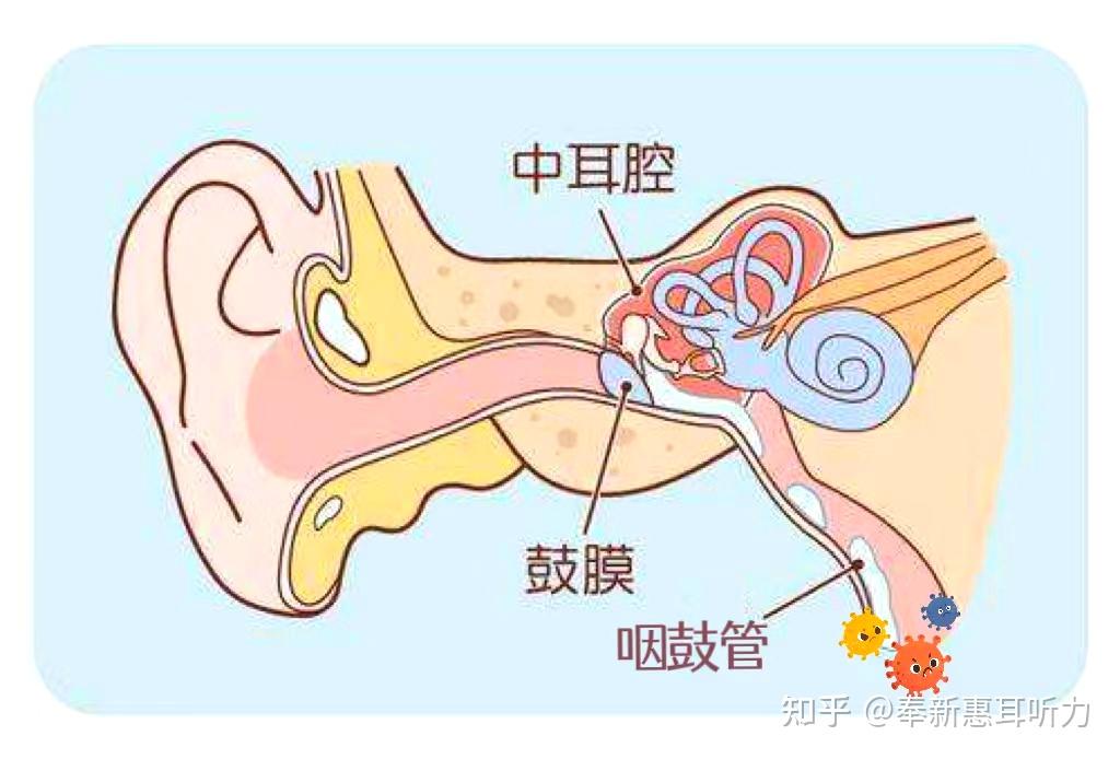 小耳朵卫士|中招“奥密可戎”，警惕急性中耳炎 - 知乎
