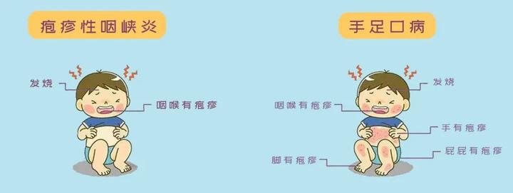 手足口病,皰疹性咽峽炎仍橫行,兒童易中招!趕快學習這篇科普!