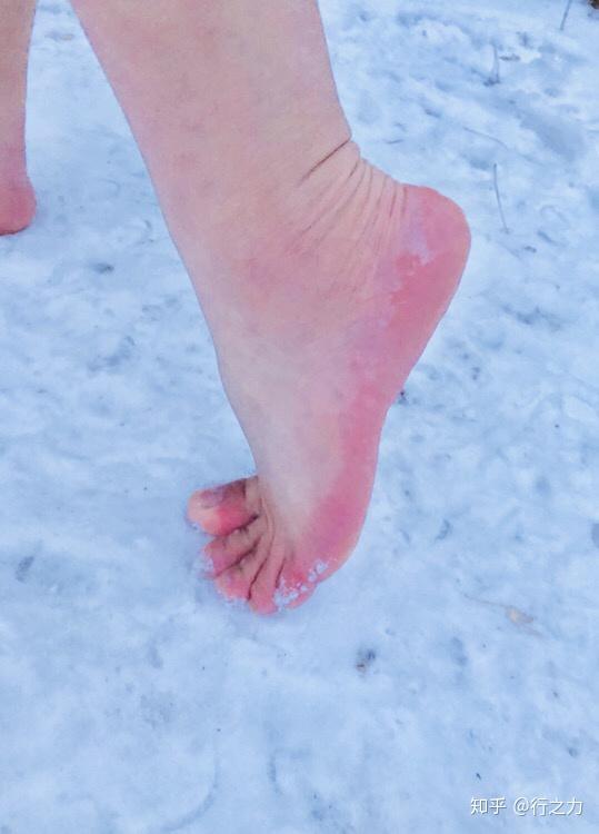冬天赤脚踩冰图片