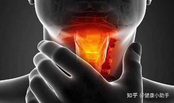 急性咽炎:探析症状、原因和治疗方法 - 知乎