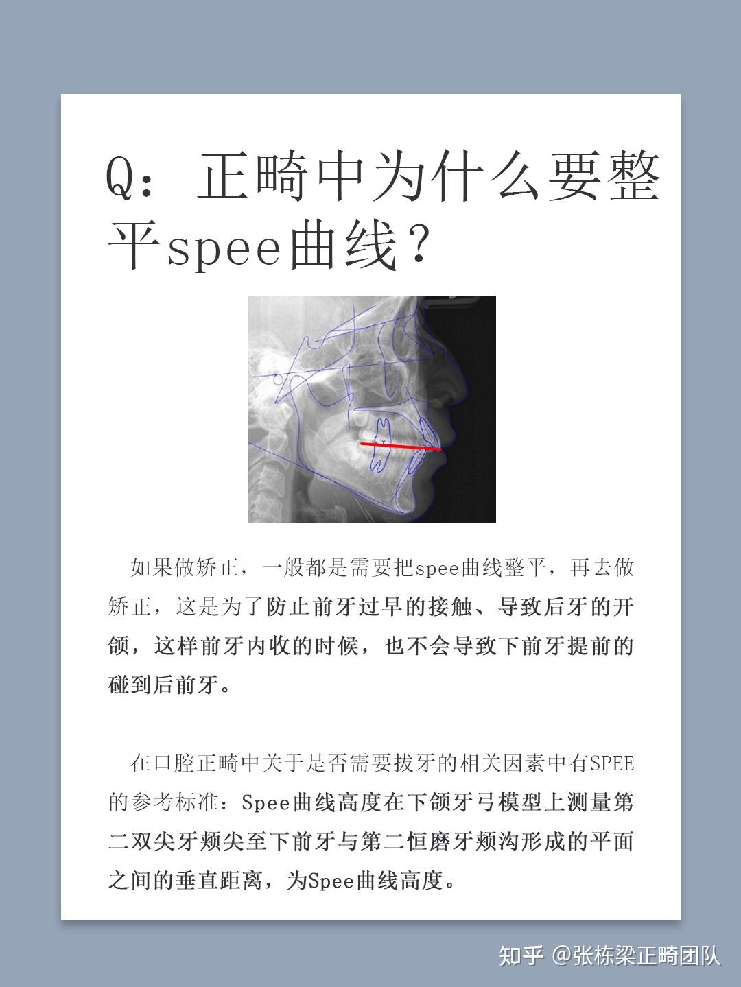 正畸中為什麼要整平spee曲線