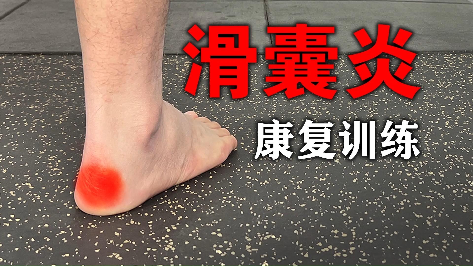 我的脚后跟处疼了3个月了走路都瘸去医院说是跟腱滑囊炎请问有什么