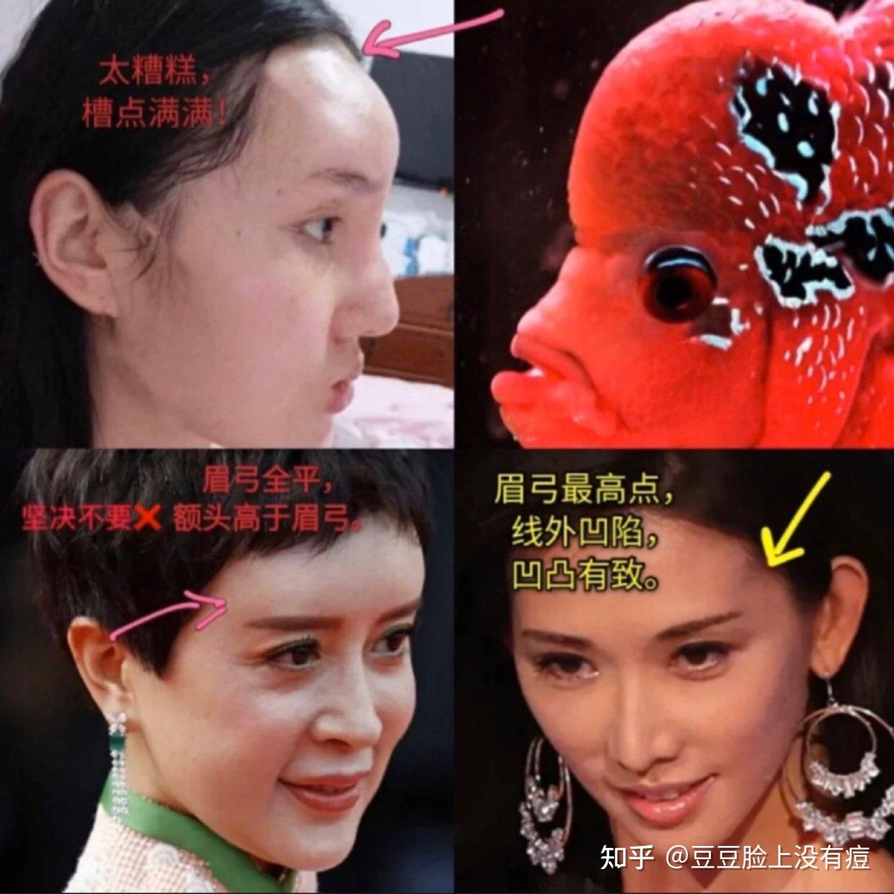 寿星额头的女人图片