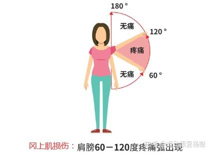 2)肩关节活动受限:活动受限以肩关节外展至60°～120°时,可引起明显