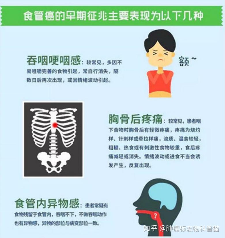 你是食管癌高危人群吗如何进行食管癌的筛查与检查肿瘤标志物scccyfra
