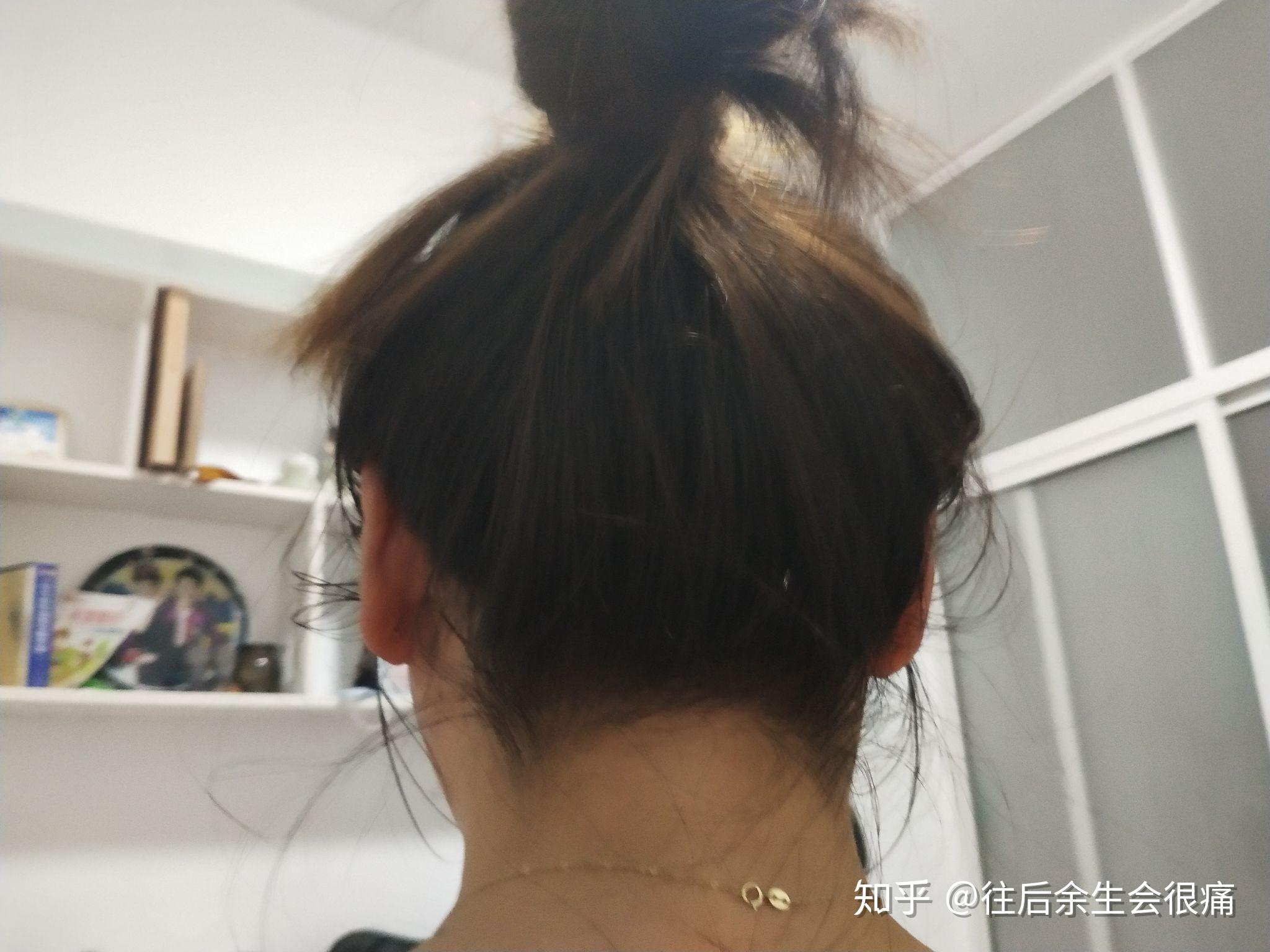 头发都长到脖子上去了,扎起来太难看了,有什么办法去掉这些头发吗?