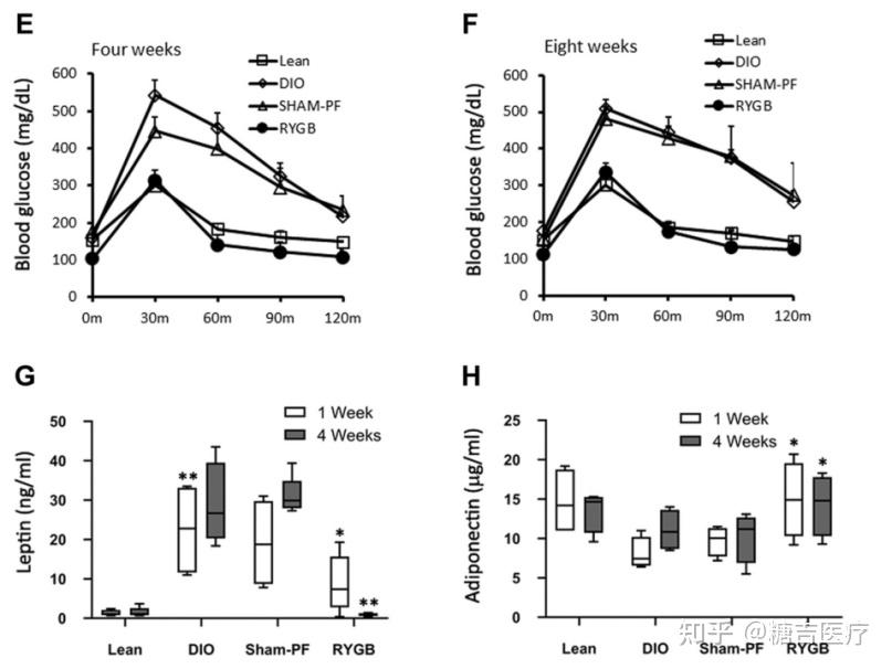 胃旁路手术改善胰岛素抵抗的机制探讨