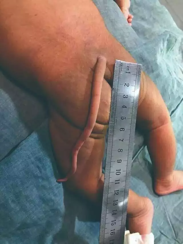 有长尾巴的人吗