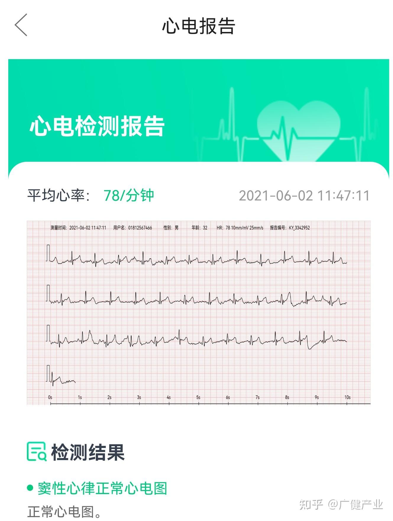体安健康手表心电测量功能让你看得见的心跳