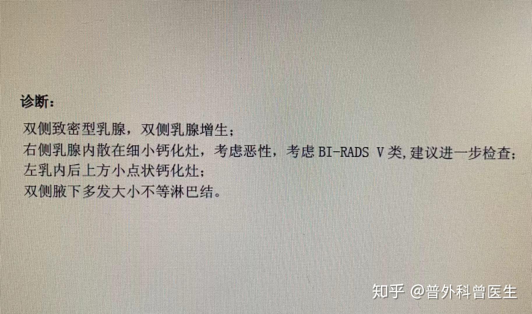 完全符合乳腺癌的特徵,放射科醫生直接報告為乳腺5類病變,考慮惡性