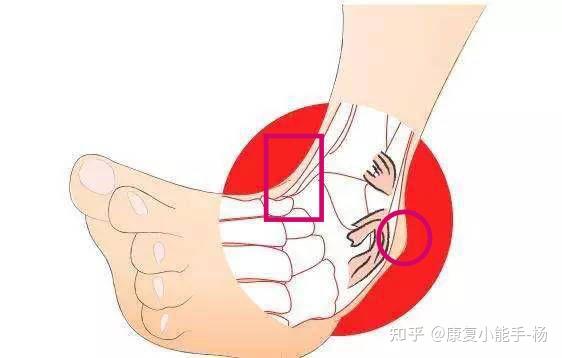 右腳內踝和右腳外踝是一個部位嗎