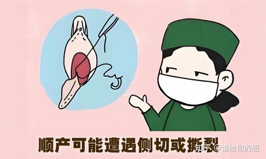 撕裂和侧切是顺产的标配?不好意思,婉拒了哈~ - 知乎