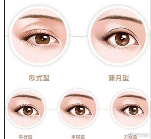 做双眼皮手术前必看攻略,需要做哪些功课?少走弯路! - 知乎