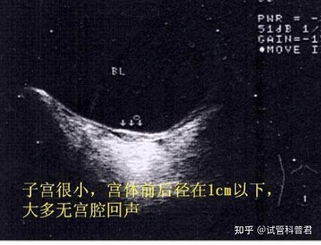 始基子宫怎么要孩子