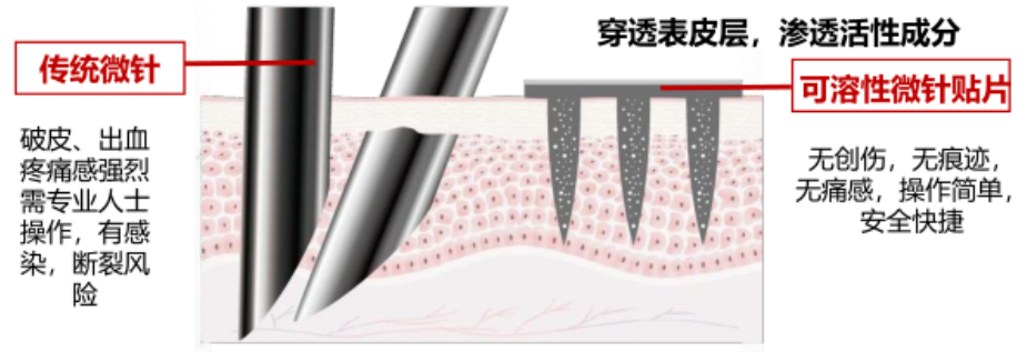 透皮新技术--可溶性微针 - 知乎