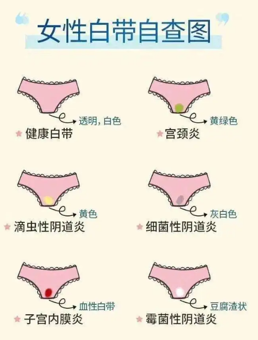 白带过多是病态 过少也是病态 那到底多少合适