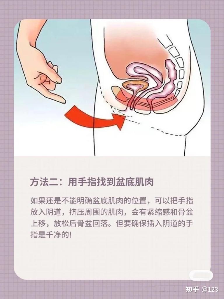 盆底肌松弛自测图解图片