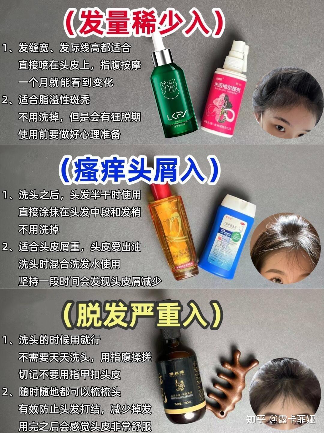 为什么老是掉头发特别厉害是什么病引起的为什么在线 为什么老是掉头发特别厉害是什么病引起的为什么在线