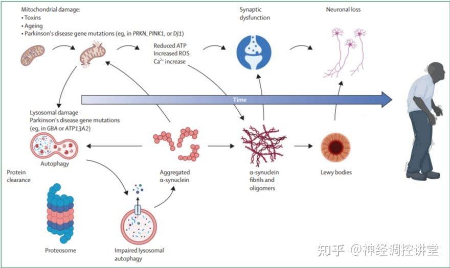 发病机制的新洞察与治疗前景——《柳叶刀》帕金森病最新深度解读系列(二) - 知乎
