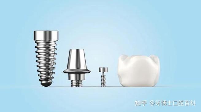 该选士卓曼(straumann)哪个系统种植牙? - 知乎