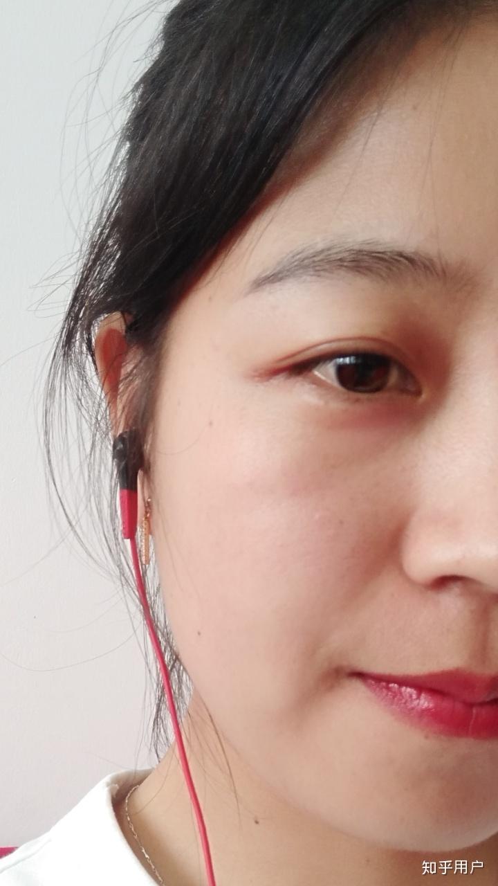 皮肤从满脸痘痘到白里透红是什么体验